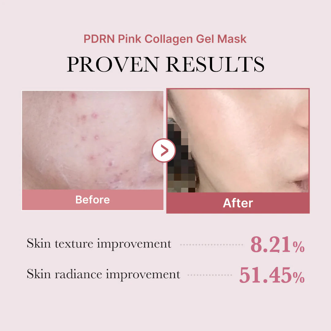[Medicube] Salmon PDRN Pink Collagen Jelly Gel Mask